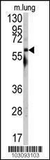 Anti-SRC Rabbit Polyclonal Antibody (AP (Alkaline Phosphatase))