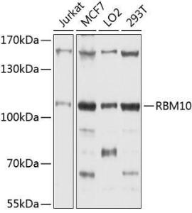 Anti-RBM10/S1-1 Antibody (A9401)