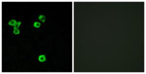 Immunofluorescence analysis of LOVO cells using Anti-RPS6KC1 Antibody. The right hand panel represents a negative control, where the antibody was pre-incubated with the immunising peptide.