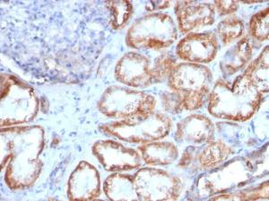 Immunohistochemical analysis of formalin-fixed, paraffin-embedded human renal cell carcinoma using Anti-HSP60 Antibody [HSPD1/780]