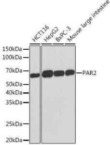 Western blot analysis of extracts of various cell lines, using Anti-PAR2 Antibody [ARC1246] (A306265) at 1:1,000 dilution