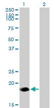 Anti-NINJ2 Mouse Polyclonal Antibody