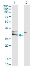 Anti-VWF Mouse Monoclonal Antibody [clone: 1A11]