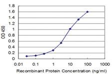 Anti-MSI1 Mouse Monoclonal Antibody [clone: 4A11]