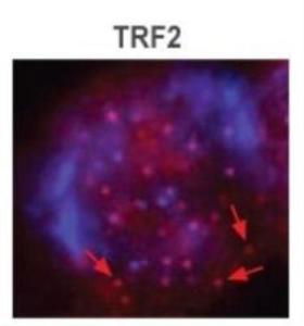 Anti-TERF2 Mouse Monoclonal Antibody [clone: 4A794.15]