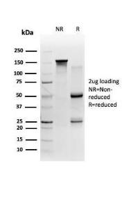 SDS-PAGE analysis of Anti-FTCD Antibody [FTCD/357] under non-reduced and reduced conditions; showing intact IgG and intact heavy and light chains, respectively. SDS-PAGE analysis confirms the integrity and purity of the antibody