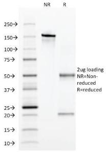 SDS-PAGE analysis of Anti-alpha 1 Antitrypsin Antibody [AAT/1379] under non-reduced and reduced conditions; showing intact IgG and intact heavy and light chains, respectively SDS-PAGE analysis confirms the integrity and purity of the antibody