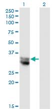 Anti-NIT1 Mouse Monoclonal Antibody [clone: 1C3]