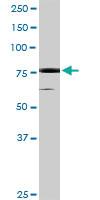 Anti-RPS6KA5 Rabbit Polyclonal Antibody