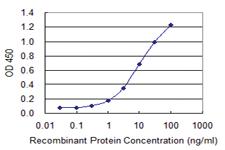 Anti-VWF Mouse Monoclonal Antibody [clone: 1A11]