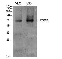 Antibody anti-desmin A95627-100 100 µg