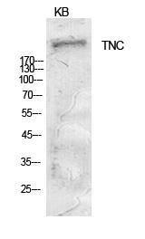 Anti-Tenascin C Rabbit Polyclonal Antibody