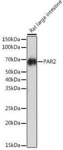 Western blot analysis of extracts of Rat large intestine, using Anti-PAR2 Antibody [ARC1246] (A306265) at 1:1,000 dilution