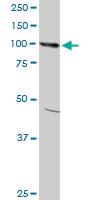 Anti-AMPD2 Mouse Monoclonal Antibody [clone: 6A8]