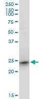 Anti-RRAS2 Mouse Monoclonal Antibody [clone: 2D3-4B8]