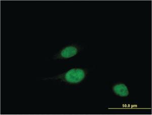 Anti-WBSCR22 Mouse Monoclonal Antibody [clone: 2E12]