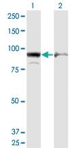 Anti-AMPD2 Mouse Monoclonal Antibody [clone: 6A8]