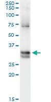 Anti-NIT1 Mouse Monoclonal Antibody [clone: 1C3]