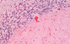 Anti-SLC7A6 Antibody (A83599) (5µg/ml) staining of paraffin embedded Human Cerebellum. Steamed antigen retrieval with citrate buffer pH 6, AP-staining.