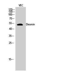 Antibody anti-desmin A95627-100 100 µg