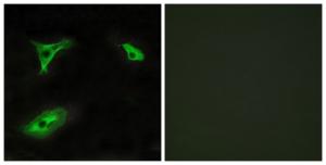 Antibody anti-GPR116 A99569-100 100 µg