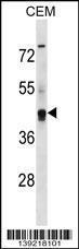 Anti-KCNG2 Rabbit Polyclonal Antibody