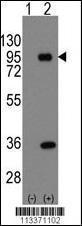 Anti-PROX1 Rabbit Polyclonal Antibody (AP (Alkaline Phosphatase))