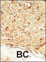 Anti-MST1 Rabbit Polyclonal Antibody (HRP (Horseradish Peroxidase))