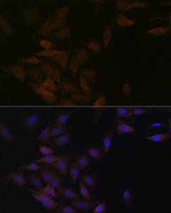 Immunofluorescence analysis of C6 cells using Anti-PP2A-alpha + PPP2CB Antibody [ARC1889] (A309172) at a dilution of 1:100 (40x lens) DAPI was used to stain the cell nuclei (blue)