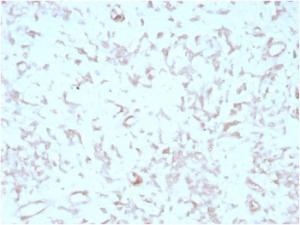 Immunohistochemical analysis of formalin-fixed, paraffin-embedded human liver tissue using Anti-Kindlin 2 Antibody [3A3]