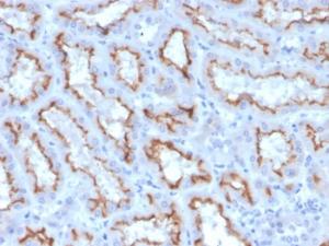 Immunohistochemical analysis of formalin-fixed, paraffin-embedded human kidney using Anti-Interferon gamma Antibody [IFNG/3996R]