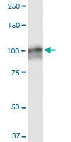 Anti-AMPD2 Mouse Monoclonal Antibody [clone: 6A8]