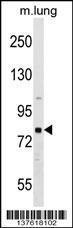 Anti-RHPN1 Rabbit Polyclonal Antibody (Biotin)