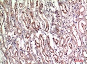 Anti-Tenascin C Rabbit Polyclonal Antibody