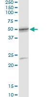 Anti-SCLY Rabbit Polyclonal Antibody