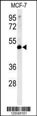 Anti-LSP1 Rabbit Polyclonal Antibody (HRP (Horseradish Peroxidase))