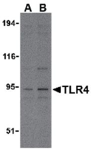 Anti-TLR4 Rabbit Polyclonal Antibody