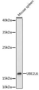 Western blot analysis of extracts of Mouse spleen, using Anti-Ube2L6 Antibody (A9425) at 1:1,000 dilution