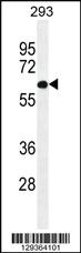 Anti-PATL2 Rabbit Polyclonal Antibody [clone: 228CT4.1.3]