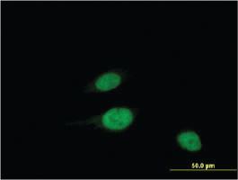 Anti-WBSCR22 Mouse Monoclonal Antibody [clone: 2E12]