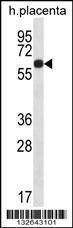 Anti-GLCCI1 Rabbit Polyclonal Antibody (HRP (Horseradish Peroxidase))