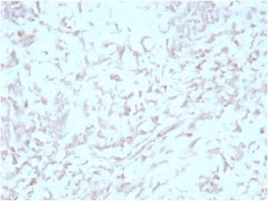 Immunohistochemical analysis of formalin-fixed, paraffin-embedded human liver tissue using Anti-Kindlin 2 Antibody [3A3]