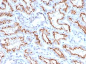 Immunohistochemical analysis of formalin-fixed, paraffin-embedded human kidney using Anti-Interferon gamma Antibody [IFNG/3996R]