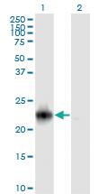 Anti-RRAS2 Mouse Monoclonal Antibody [clone: 2D3-4B8]