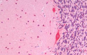 Anti-SLC7A6 Antibody (A83600) (5µg/ml) staining of paraffin embedded Human Cerebellum. Steamed antigen retrieval with citrate buffer pH 6, AP-staining.