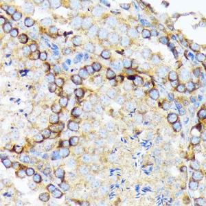 Immunohistochemistry analysis of paraffin-embedded mouse testis using Anti-eIF2A Antibody [ARC1712] (A305361) at a dilution of 1:100 (40x lens) Perform microwave antigen retrieval with 10 mM Tris/EDTA buffer pH 90 before commencing with IHC staining protocol