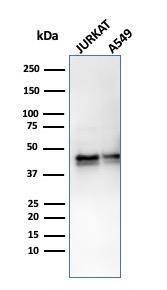 Anti-alpha 1 Antitrypsin antibody