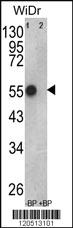 Anti-PCDHA9 Rabbit Polyclonal Antibody