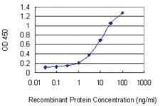 Anti-WBSCR22 Mouse Monoclonal Antibody [clone: 2E12]