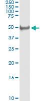 Anti-SCLY Rabbit Polyclonal Antibody